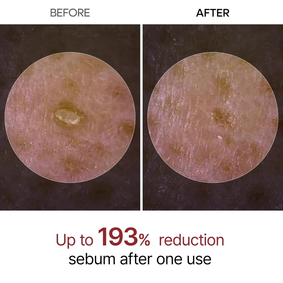 The Original Peel Shot™