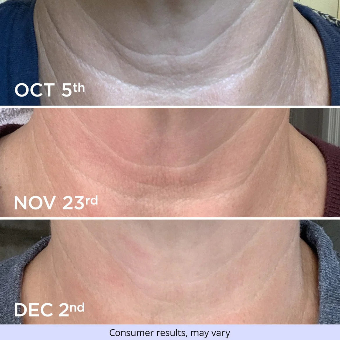 SUTHE - Tighten & Lift Neck Cream