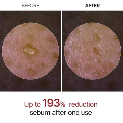 The Original Peel Shot™