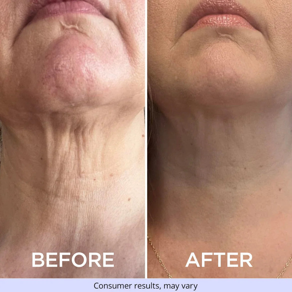 SUTHE - Tighten & Lift Neck Cream